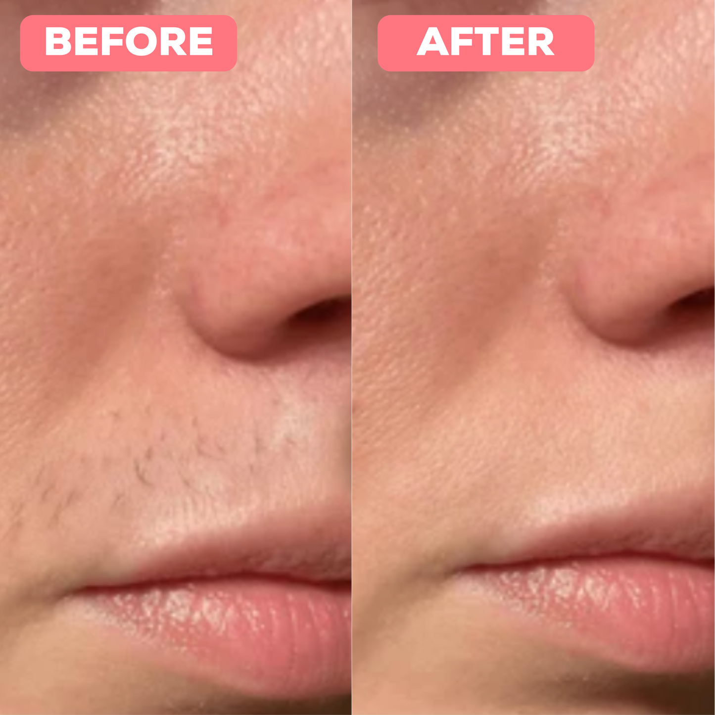 PLuxe Pro Epilator