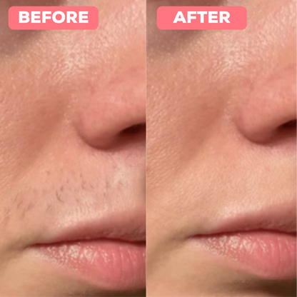 PLuxe Pro Epilator